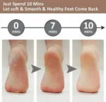 Electric Foot Callus Remover – Appareil Rechargeable pour Retirer la Peau Dure – Image 5