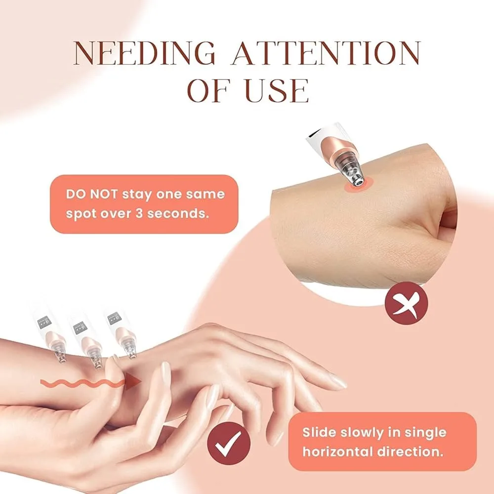 Aspirateur de Pores Visage – Nettoyeur de Points Noirs Rechargeable USB – Image 6